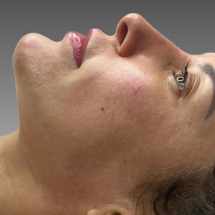 Consulta de planejamento facial individualizado na Clínica Plenna Goiânia